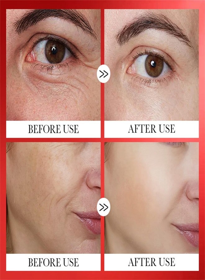 Cappuvini Anti Wrinkle Pill Serum, Anti-Wrinkle Essential Oil, Firmness/Lifting/Anti Wrinkle/Smoothing/Skin Beauty, Anti-Aging Pill Serum 5 Benefits for Beautiful Skin (Anti-Wrinkle Pill) - Image 2
